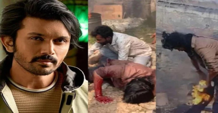 শুটিংয়ে অগ্নিদগ্ধ আরেফিন শুভ